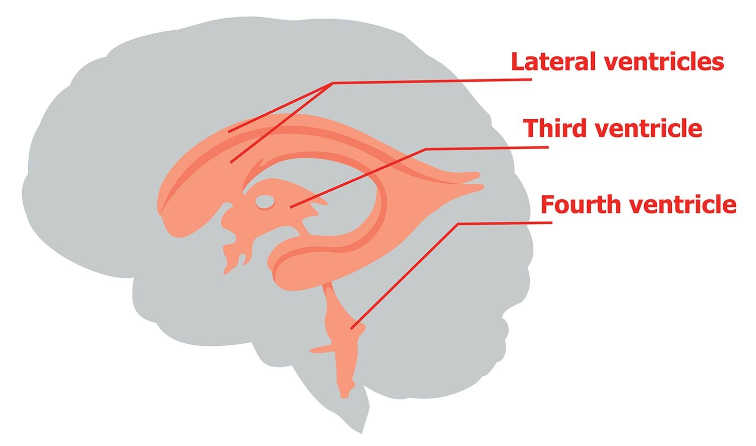 types of brain ventricle