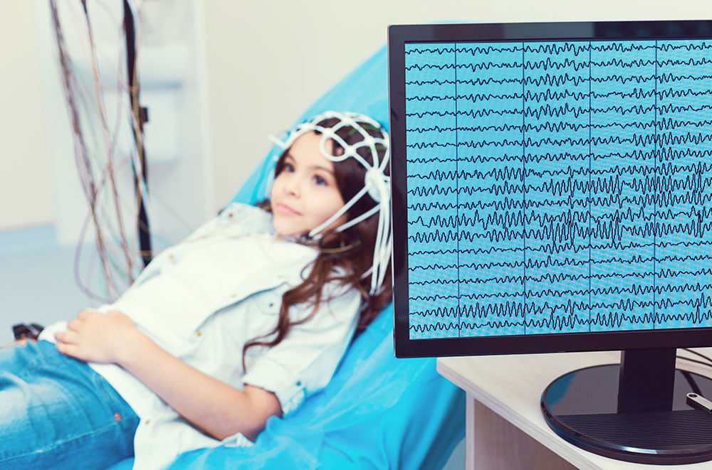 Electroencephalogram (EEG) Test