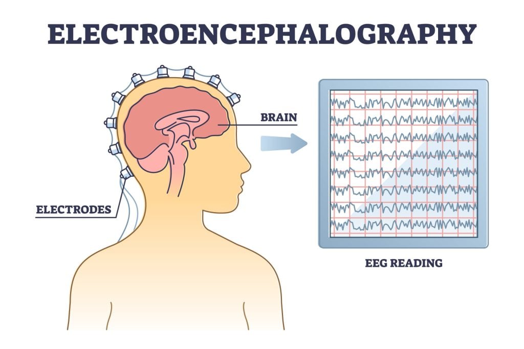 Electroencephalography or EEG as brain activity monitoring outline diagram. Medical health examination with electrodes and reading monitor vector illustration. Head measurement process explanation